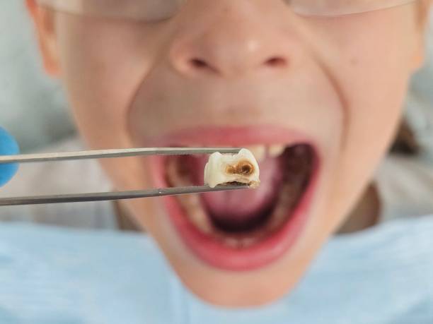 Best Emergency Treatment for Oral Infections in Rossford, OH